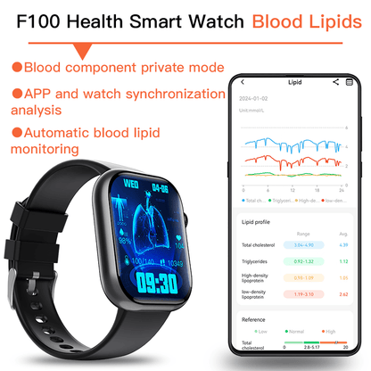 Best ECG Smart Watch of 2025 With Blood Pressure Monitor+Blood Glucose Monitoring - BOUTIQUEAMINESHOP.onlin